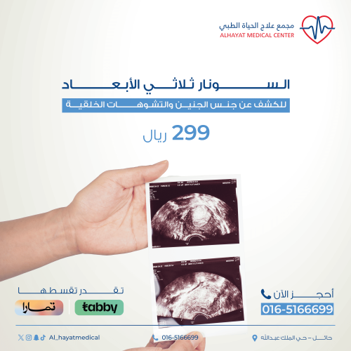 السونار ثلاثي الابعاد