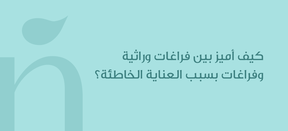 كيف أميز بين فراغات وراثية وفراغات بسبب العناية الخاطئة؟