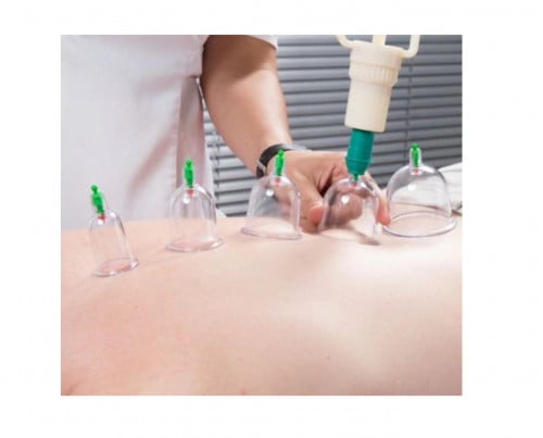 سباكير كاسات حجامة 12 كأس