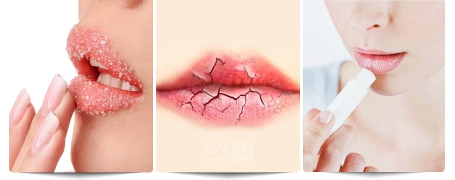 نصائح فعّالة للحفاظ على شفاه صحية في جميع الفصول"