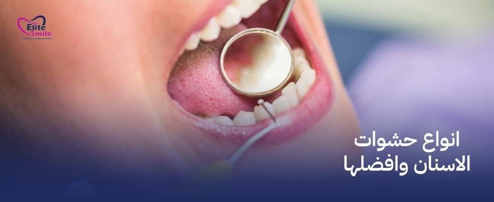 انواع حشوات الاسنان وافضلها