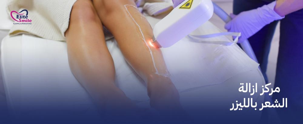 مركز ازالة الشعر بالليزر