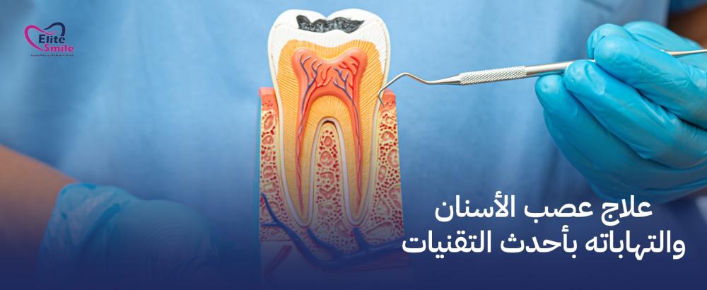 علاج عصب الأسنان والتهاباته بأحدث التقنيات