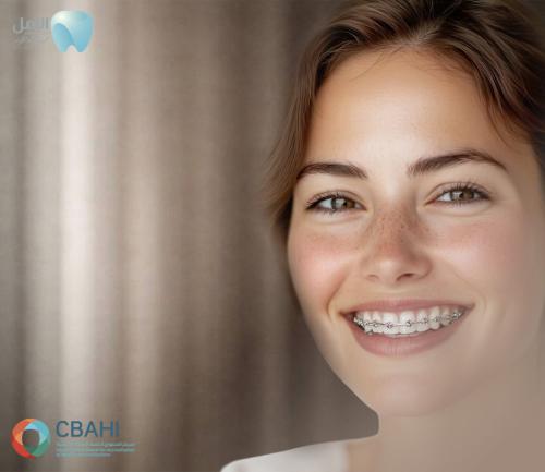 تركيب تقويم - فك واحد