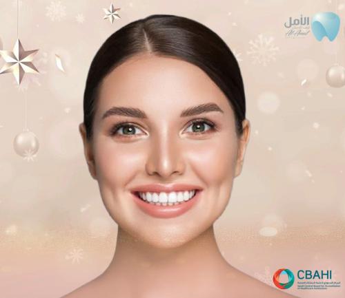 ازالة التقويم مع الصمغ فك واحد