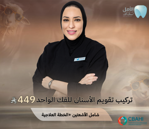 تركيب تقويم - فك واحد