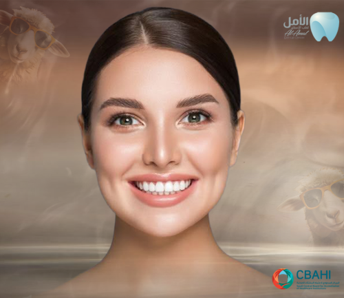 ازالة التقويم مع الصمغ - فكين