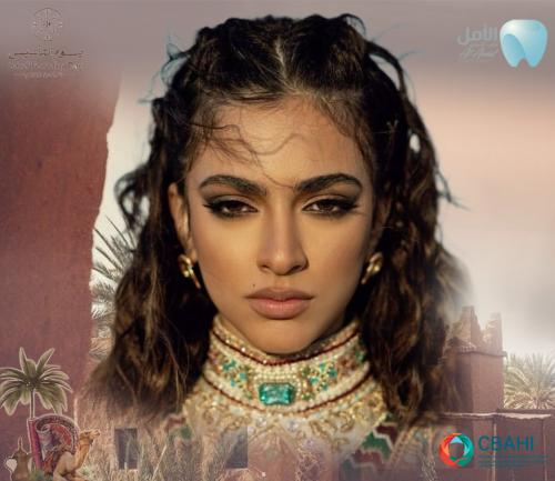 دايركت فينيرز