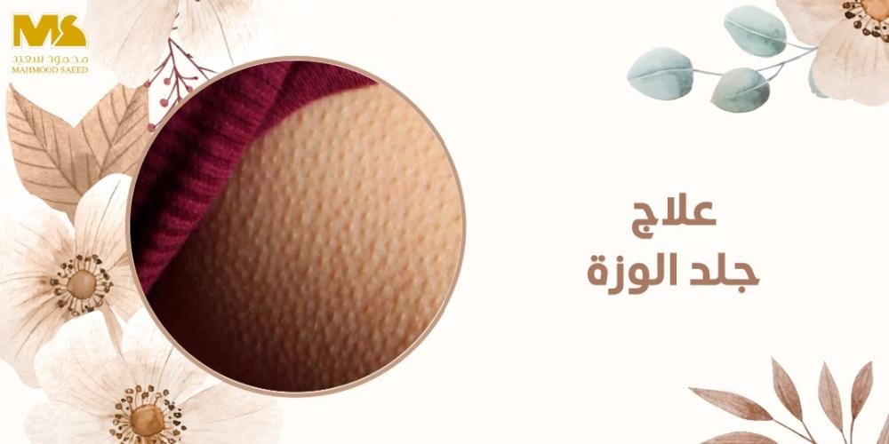 علاج جلد الوزة