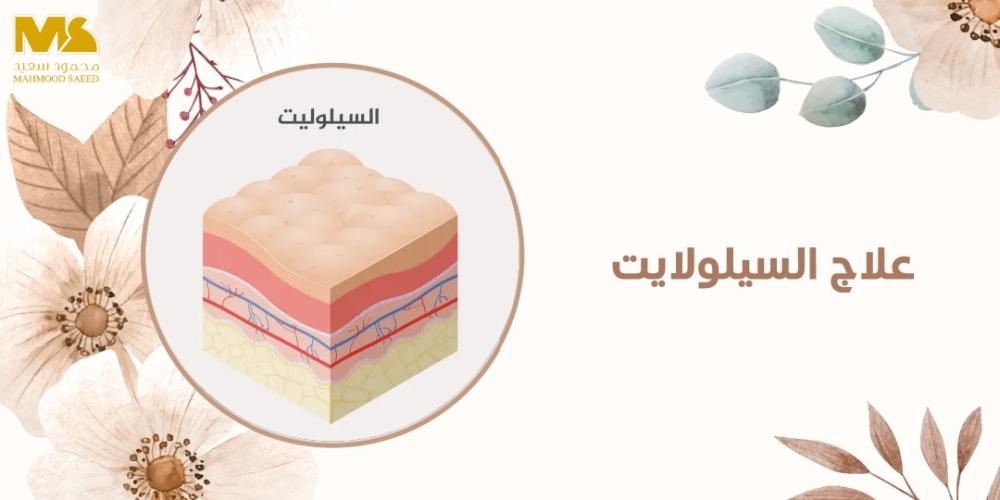 علاج السيلولايت