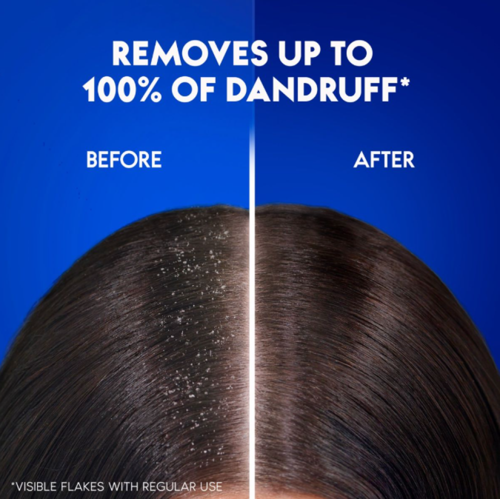 هيد اند شولدرز شامبو انتعاش التفاح 600 مل