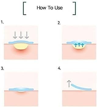 سوم باي مي - المعجزه رقع حب الشباب
