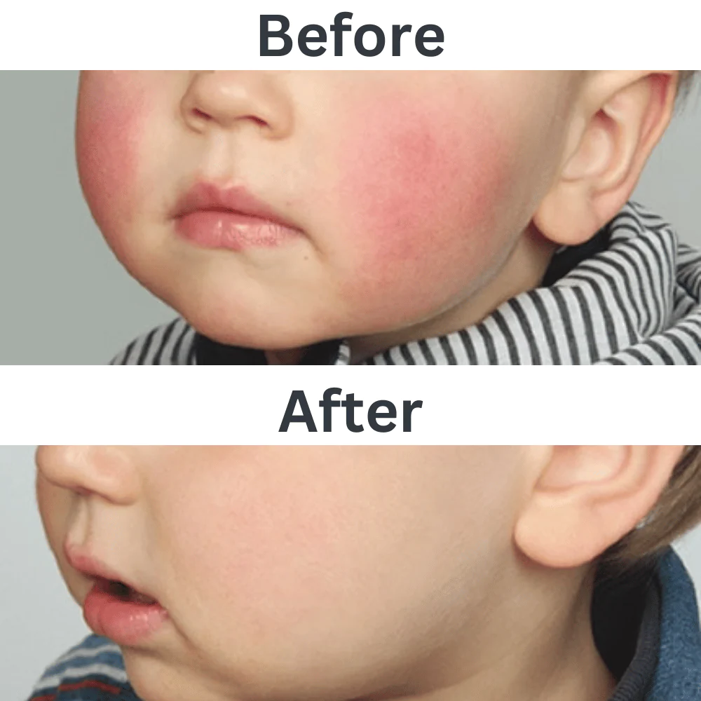 ايسدن نيوتراتوبك كريم مرطب للوجه 50 مل