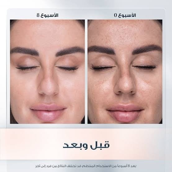 يوسرين ايفن بيغمنت بيرفكتور كريم النهار لتوحيد لون البشرة 50 مل SPF 30