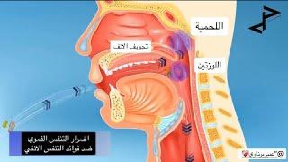 مصحح تنفس لعلاج هضبة الانف وتراجع الفك