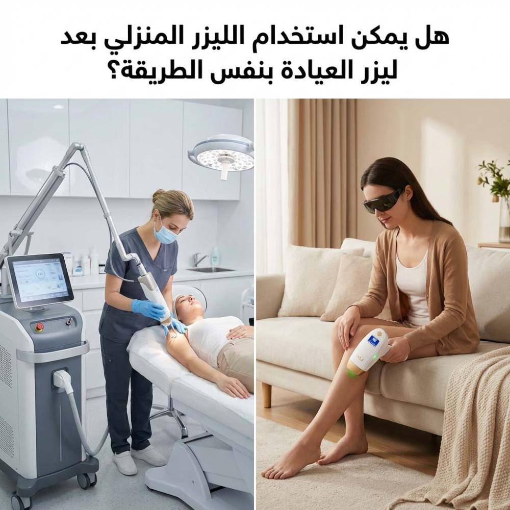 هل يمكن استخدام الليزر المنزلي بعد ليزر العيادة