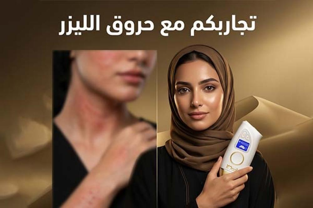 تجاربكم مع حروق الليزر