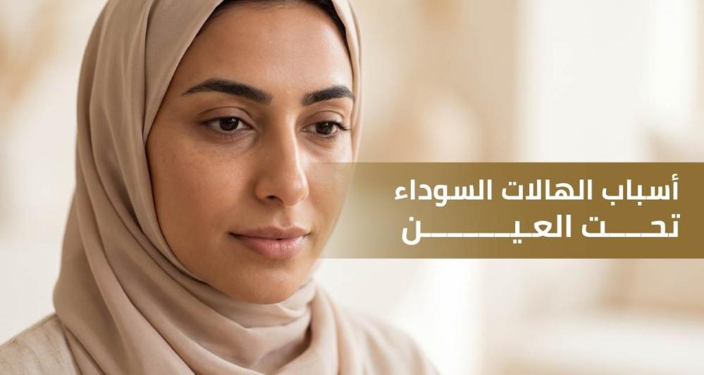 أسباب الهالات السوداء تحت العين | لماذا تظهر رغم النوم؟