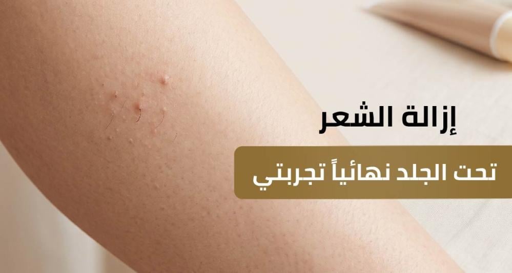 إزالة الشعر تحت الجلد نهائياً تجربتي