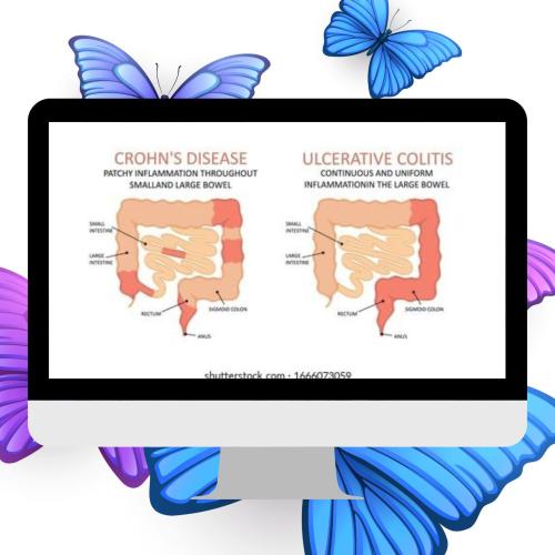 IBD treatment