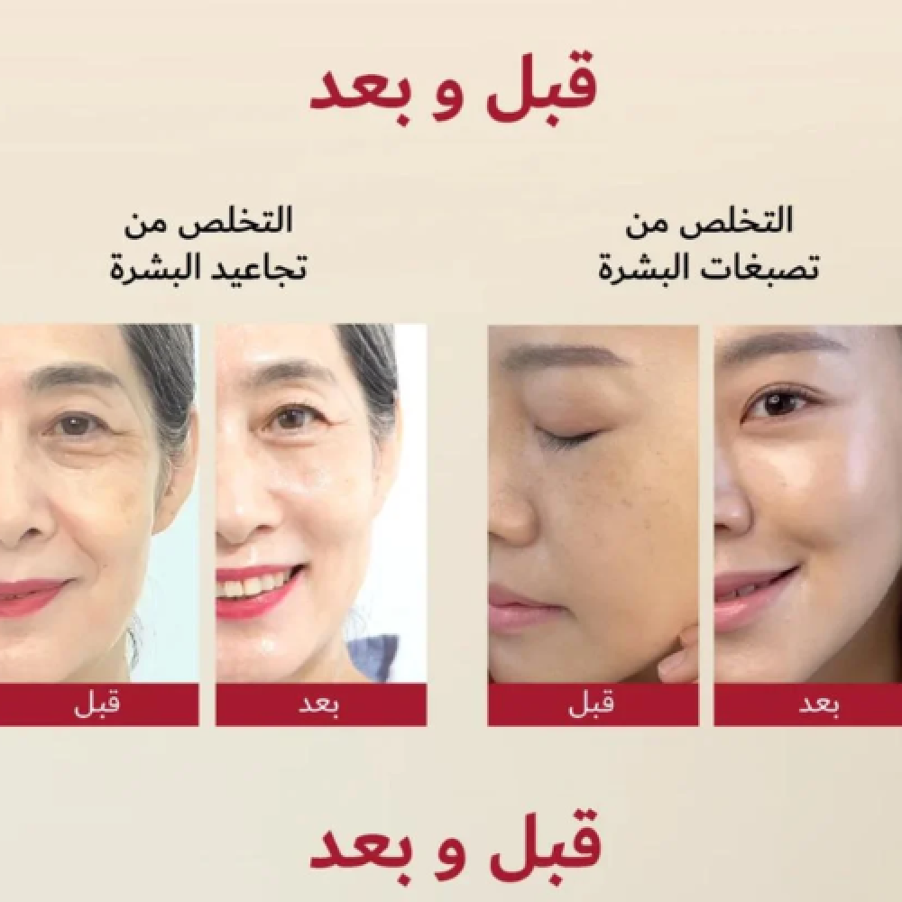 سيروم الكوري الاحمر
