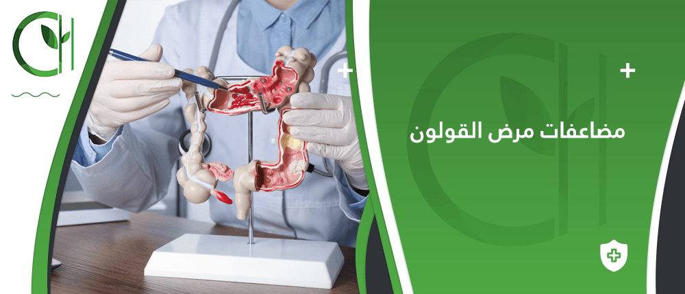 ما هي مضاعفات مرض القولون