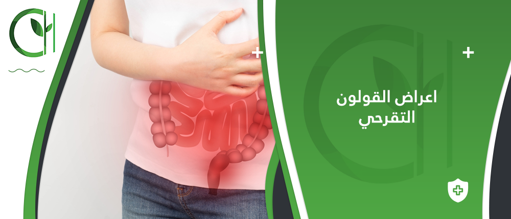 هل الوراثة تلعب دورًا في احتمالية الإصابة بالقولون و أعراض القولون التقرحي؟