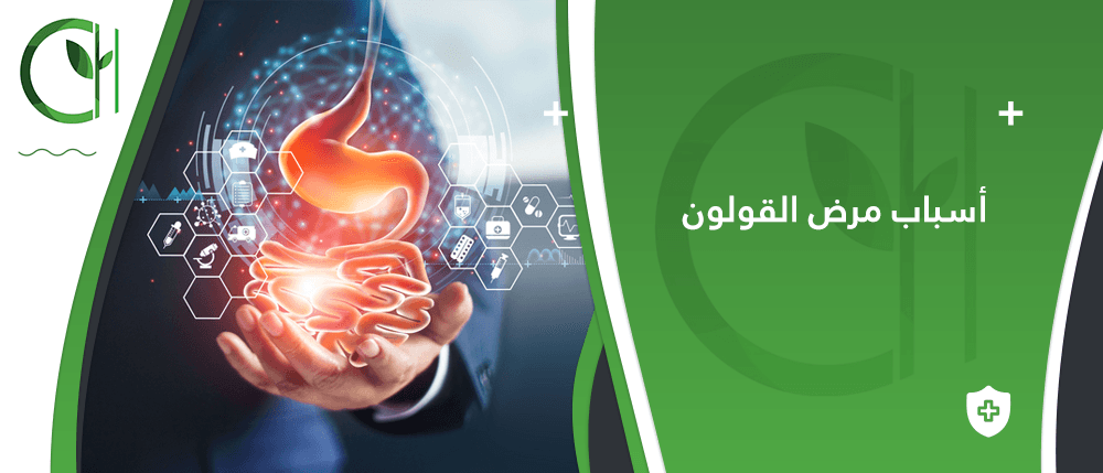 أسباب مرض القولون : كيف اعرف ان لدي مرض القولون؟