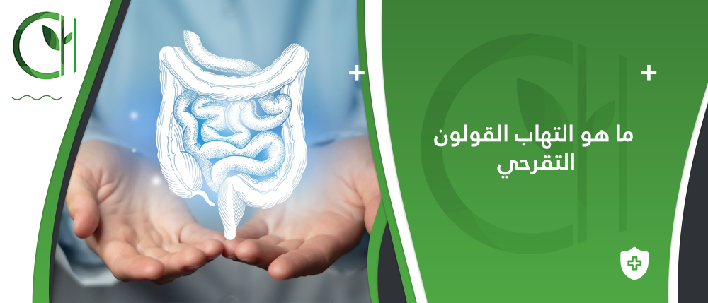 فهم أعراض التهاب القولون التقرحي: العلامات المبكرة والتشخيص الفوري