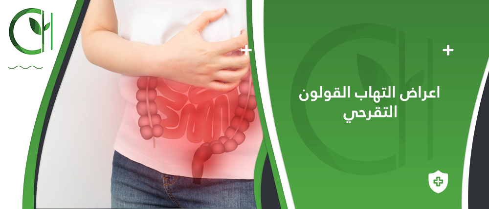 فهم أعراض التهاب القولون التقرحي: العلامات المبكرة والتشخيص الفوري