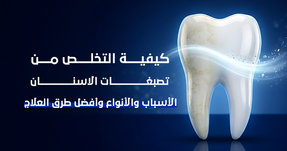 كيفية التخلص من تصبغات الاسنان
