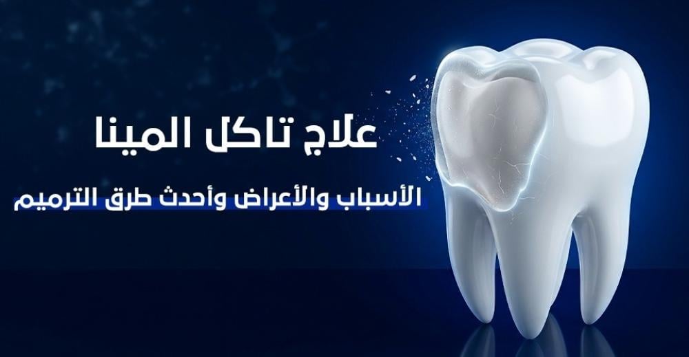 علاج تاكل المينا