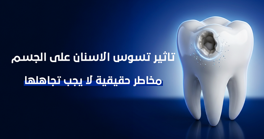 تاثير تسوس الاسنان على الجسم