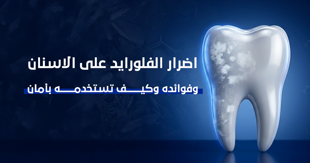 اضرار الفلورايد على الاسنان