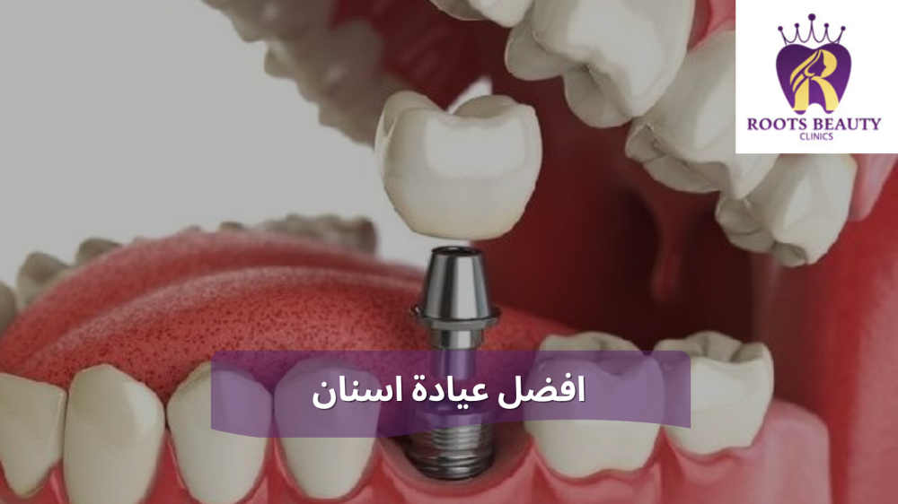 افضل عيادة اسنان