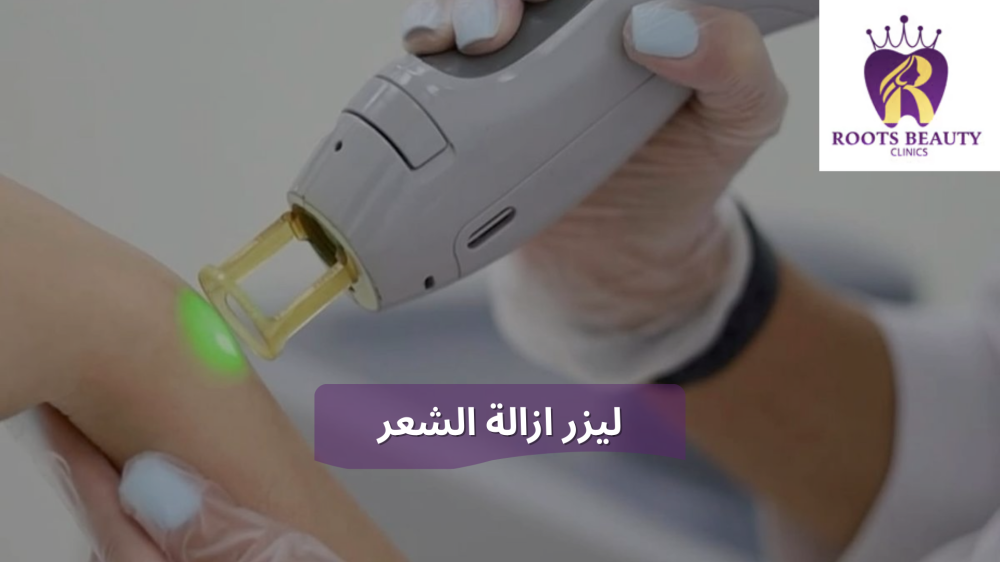 ليزر ازالة الشعر