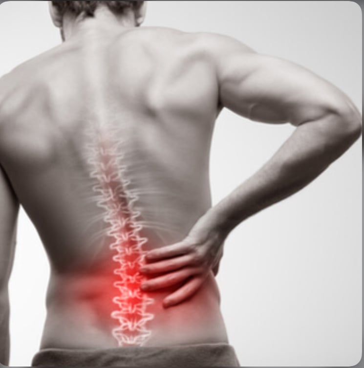 سمارت ثيربي