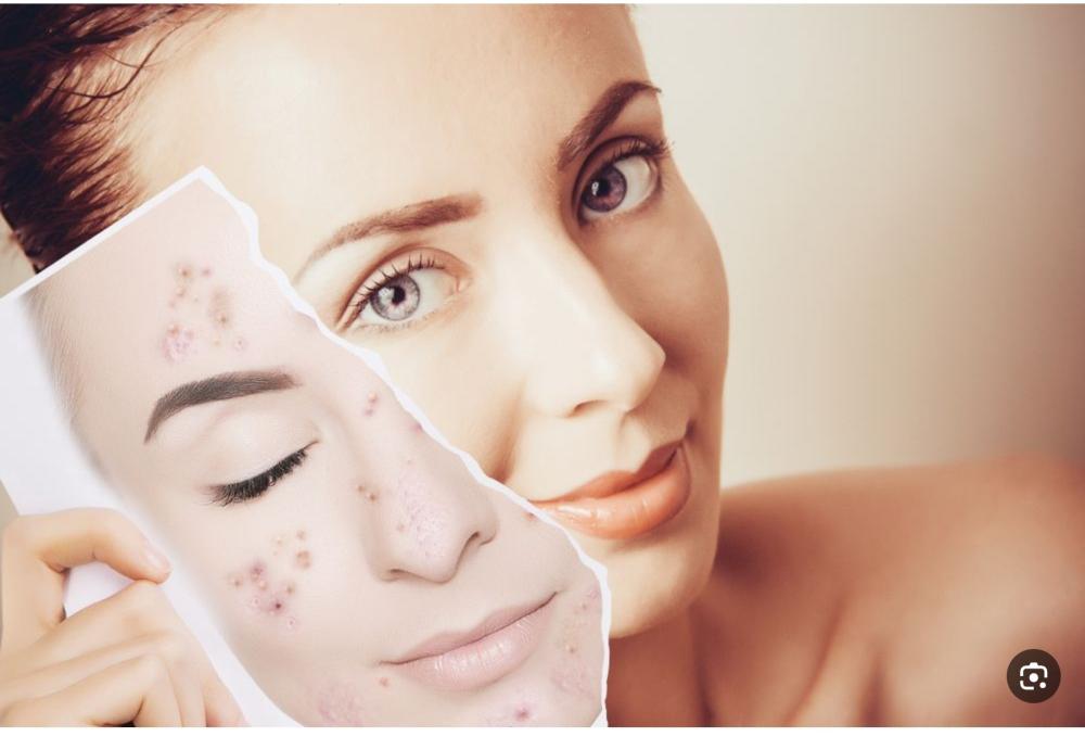 للتعامل مع تصبغات البشرة