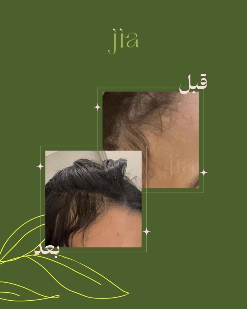 زيت جيا لإنبات الشعر