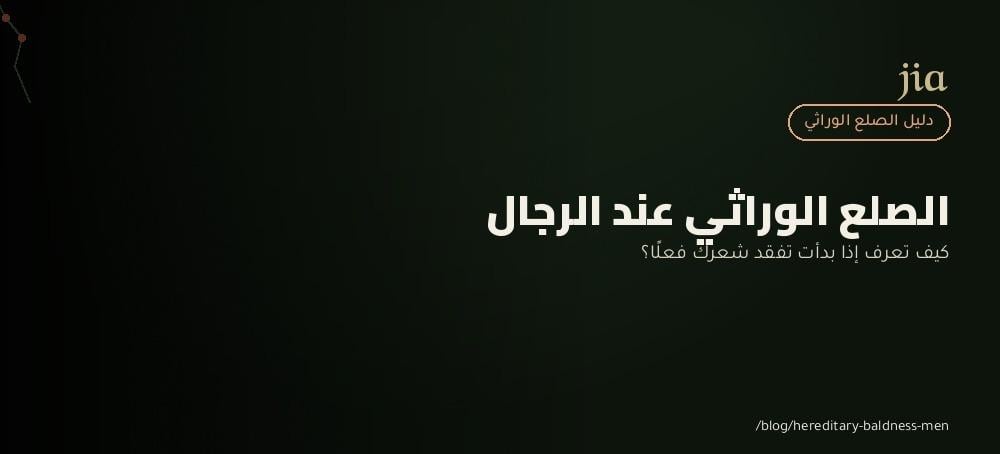الصلع الوراثي عند الرجال | كيف تعرف العلامات المبكرة قبل تفاقم المشكلة
