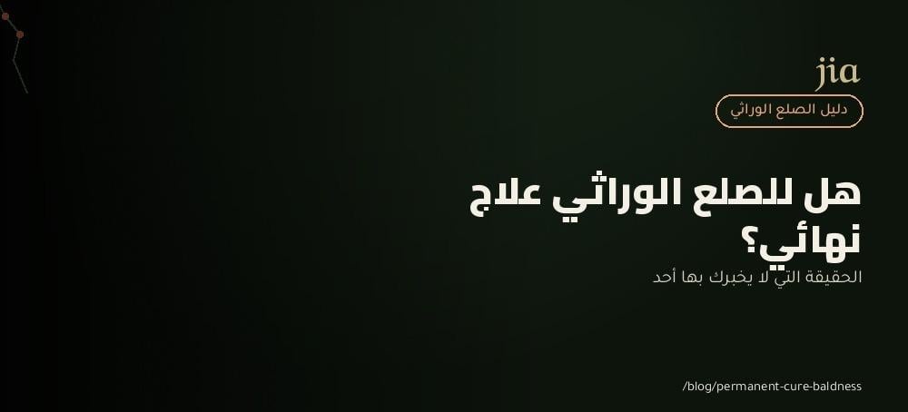 هل الصلع الوراثي له علاج نهائي؟ الحقيقة الكاملة قبل أن تصدق أي إعلان