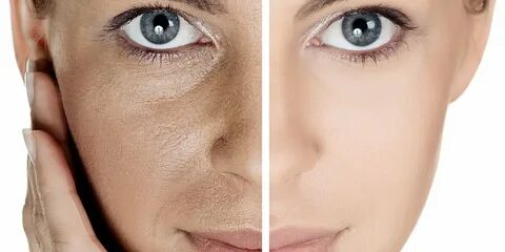 كيف يساعد الكولاجين والهيالورونيك على محاربة الشيخوخة