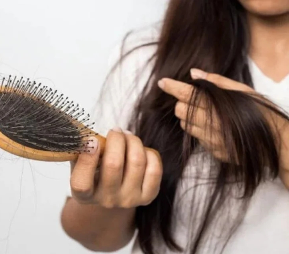 أسباب تساقط الشعر