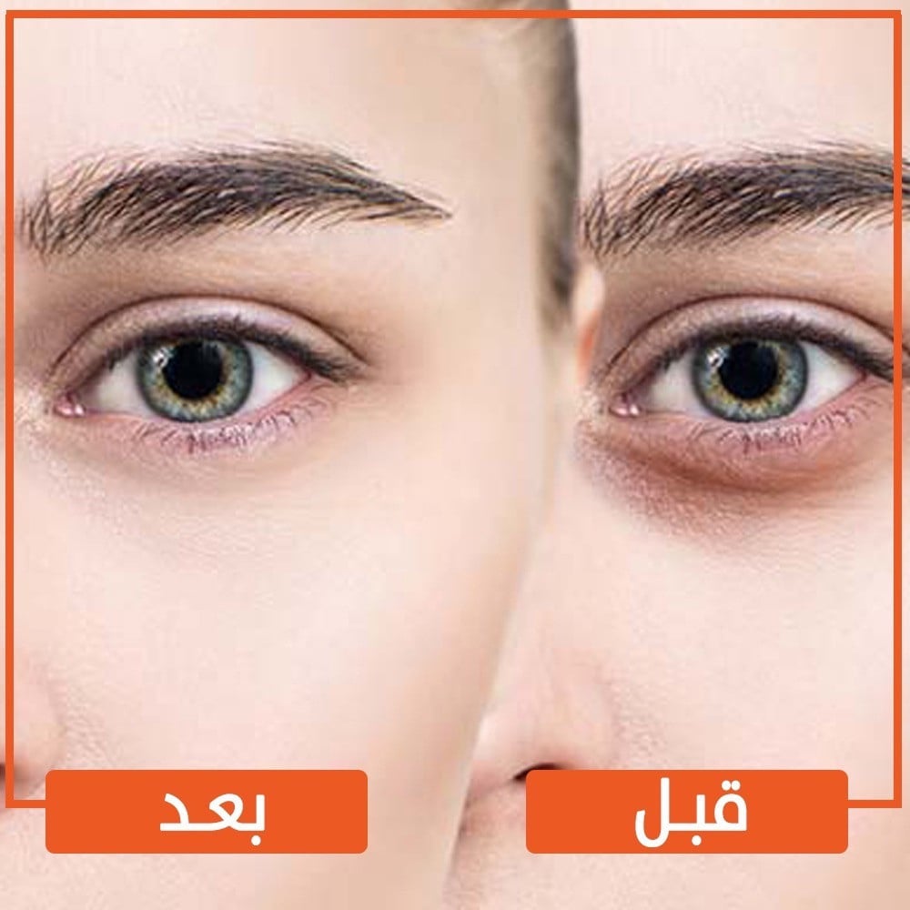 سيروم الكافيين لهالات العين من ذااوردناري