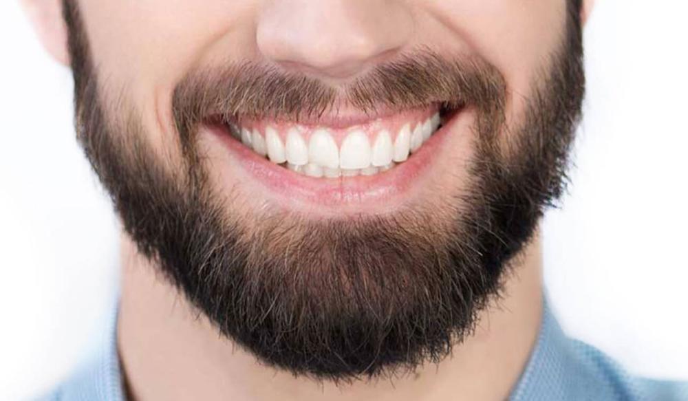 تحديد الشنب