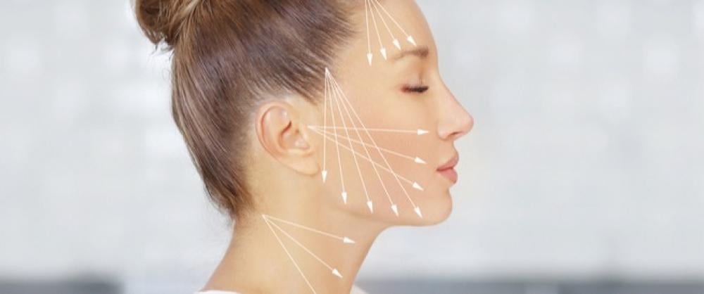 خطوات عملية شد الوجه بالخيوط