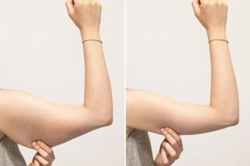 عملية شد الزنود