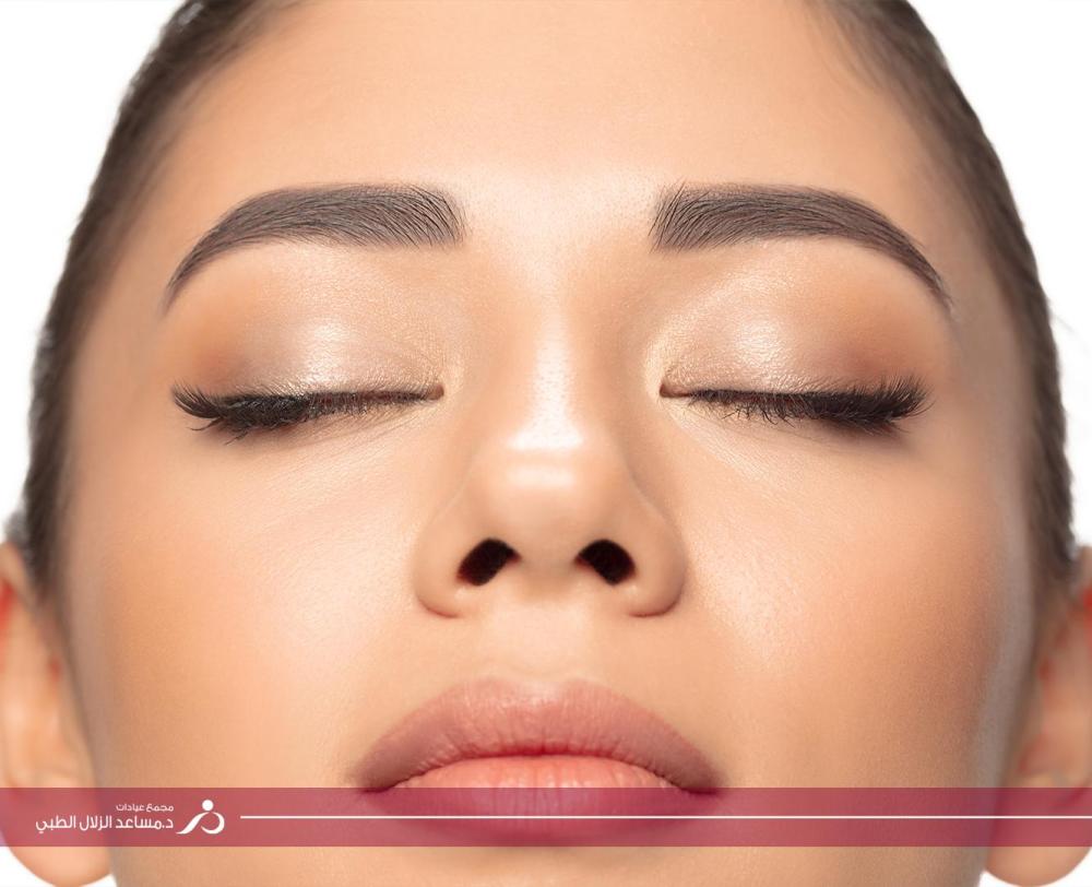 هاليورانيك+راديس-الرياض