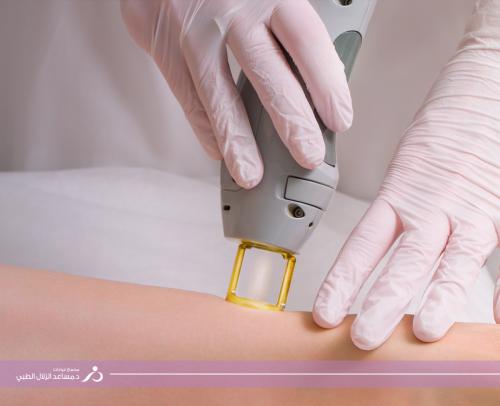 ( للرجال ) ازالة شعر الارداف