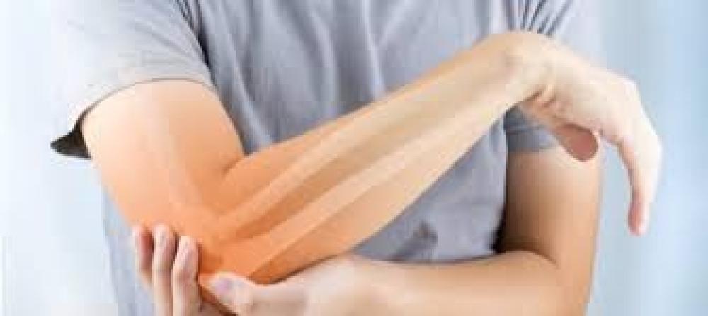 هشاشة العظام